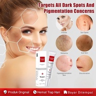 YouBuy Whitening Cream Resmi BPOM KRIM KHUSUS FLEK HITAM & BINTIK BINTIK HITAM MELASMA Penghilang Fl