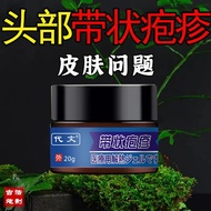 Herpes zoster on the head, post-herpetic sequelae, neuralgia, snake sore cream, sna头部带状疱疹带状疱疹后遗症神经痛蛇