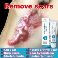 scar removal cream hilangkan parut scar cream scar reducer 20g acne scar treatment hilangkan parut j