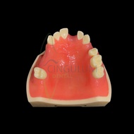 Dental implant model dental implant model