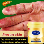 Vaseline Hand Cream Foot Treatment Cream Whitening Anti Cracking Moisturizing Anti-cracking Anti-freezing Anti-drying Anti Chapping skin care 170G 凡士林保湿霜
