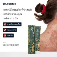 Kreain Nature×Dr.YuTitan เจลดูแลผิว สำหรับปัญหาผิวหนังและอาการระคายเคือง
