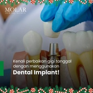 Veneer gigi / implant gigi / dokter gigi pik / gigi palsu / tanam gigi