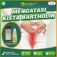Obat Kista Bartholin Benjolan vagina Mis v herbal Kista Rahim Ovarium epidermoid payudara Propolis