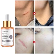 ♛▤  Scar Removal Cream Surgical Scar Hyperplasia Burn Scar Removal Cream Cesarean Scar Repair Liquid Scar Treatment Essential Oil