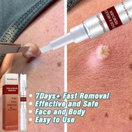 Warts remover original Mole remover Skin tag remover Removal freckle and melanin spots