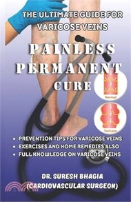 The ultimate guide for Varicose veins: painless, permanent cure and tips to prevent varicose veins