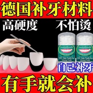 Own Filling Teeth Imported Nano Filling Teeth Material Resin Filling Temporary Fake Filling Teeth Fi