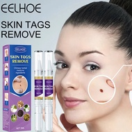 Warts Mole Remover Serum Pen Wart Treatment Pen Skin Tags Removing Liquid Pen Ubat Kutil Removal Tag