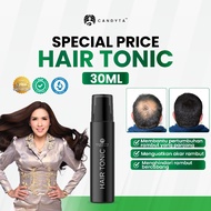 [DIRECT DARI HQ] CANDYTA HAIR TONIC 30ML For Hair Growth Rambut Lebat Ratu Candyta Eira Syazira