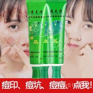 【祛痘膏】Acne cream露兰姬娜祛痘膏痘克苦瓜祛痘膏消去豆豆祛痘印痘疤淡化痘印抗痘印艾美靓妆·dhihighi