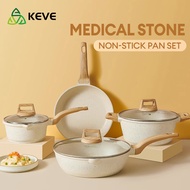 KEVE 4 Pcs Big Size Medical Stone Non Stick Cooking Ware Set Kitchenware Cookware Set Pots for Cooking Set