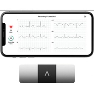 Alivecor Kardia Mobile six lead