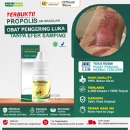 Obat Tetes Herbal Pengering Luka Obat Luka Luar Cepat Kering Luka Diabetes Luka Bernanah Luka Bakar 