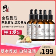 Correct Ginger About Anti-Hair Loss Hair Loss Shampoo Anti-Hair Loss Hair Student Official Hair Loss Correction Ginger About Anti-Hair Loss Shampoo Anti-Hair Loss Hair Loss Hair Loss Hair Student Official