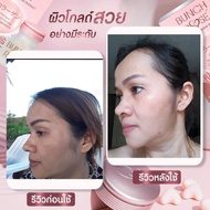 อาหารเสริมผิวสว่างกระจ่างใส แถมขวดน้ำแบบแก้ว1 ขวด แบบซอฟเจล ขนาด 1กระปุก มี 20ซอฟเจล Bunch Rose Coll