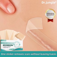 【SG Shipping】Dr.jungle Scar removal patch, silicone gel scar removal and skin repair, invisible shap