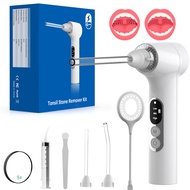 Cross-Border New Style Electric Tonsel Body Calculus Remover Oral Calculus Cleaning Care Tool