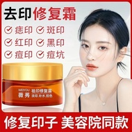 Ready Stock moles, spots, red marks and black marks, laser marks, l moles spots Remove red marks bla