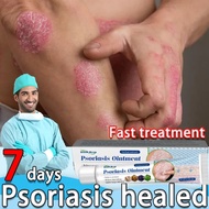South Moon Gamot sa kati kati sa balat Herbal Psoriasis Dermatitis Eczema Pruritu Psoriasis Cream Oi