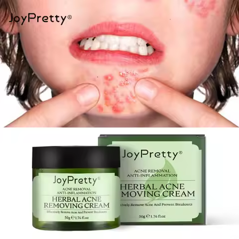 JoyPretty Herbal Acne Removal Face Cream Against Pimple Remover Ance Treatment Anti Ance Moisturizin