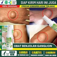 Sumifun Obat lipoma benjolan paling ampuh Obat Lipoma Herbal Benjolan Lipoma Penghilang Benjolan di 