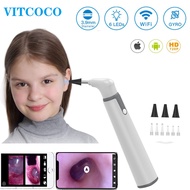 Ear Camera Endoscope 3.9mm Wireless Otoscope 720P HD WiFi Ear Scope with 6 LED for Kids and Adults S