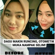 Face Shaper Dolly v shape beautiful face Bentuk Muka Runcing Kurus