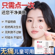 点痣膏脸部去痣膏美容院无痛专用无痕正祛斑点痣药水抑菌乳膏点雀平瘊膏痦子凸痣除痣灵品优肤平抗菌液 一盒就够了