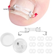 honeypanda 1/2 Set Ingrown Toenail Corrector Tools Pedicure Recover Embed Toenail Treatment Professi