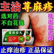 KY-JD Urticaria pills Traditional Chinese Medicine for Urticaria Curative Effect Medication of Urtic