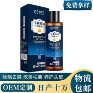 Follicle Yan Yanning Cleansing Shampoo Follicle Yan Anti-Dandruff Anti-Itching Scalp Follicle Cream 