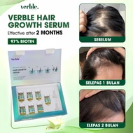 VERBLE Hair Growth Serum Women | Hair Fall Control Serum | Scalp Care For Thinning Hair For Women 7 