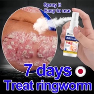 Psoriasis Spray Relief Psoriasis Eczema Ringworm Antifungal Itch Relief 60ml