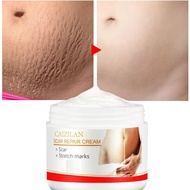 ↂ♚✚  Effective Scar Repair Cream Remove Acne Scar Pregnant Women Skin Care Stretch Mark Removal Maternity Fat Gravid Striae Treatment