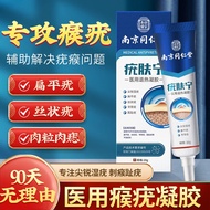 疣肤清宁瘊子脱落灵去除脖子颈部小肉粒尖锐湿专用非药丝状寻常跖脚底趾疣可搭咪喹奎莫特5%五氟乳膏 1盒体验装【适合轻度疣体】