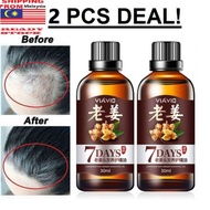 Pelebat Rambut Anti Gugur 7 Days Hair Growth Oil Serum Tonic Ginger Ori COMBO