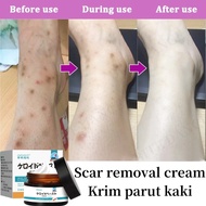 Ubat parut Hilangkan parut hitam Hilangkan parut kaki Menghilangkan bekas luka lama Scar Burns Parut