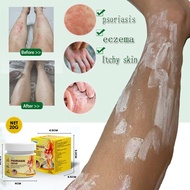 Itchy skin cream, antibacterial eczema cream, antifungal cream, fast and effective relief of itchy s