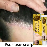 Psoriasis Prevention Cream Cream Cream for itchy fungus, ringworm, hives, keratosis, dermatitis, rin
