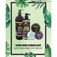 💚SGS TESTED❌STEROIDS❌ECZEMA BABY ALMA BALM lotion CHILDREN ADULTS Antifungal Ubat Kulit Gatal Ekzema