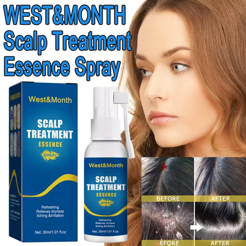 WEST&MONTH Scalp Treatment Essence Spray Repair Scalp Hair Follicles Balance Water Oil Nourish Scalp