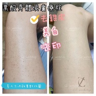 元朗/荔枝角🧘🏻‍♀️身體果酸療程⛄️雞蛋肌必做🔥去雞皮💫 毛囊炎⚠️毛囊角化症天水圍