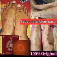 Authentic Tibetan Soap Sabun hilangkan parut kudis Sabun parut kaki Hilangkan Bekas luka lama parut 