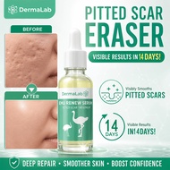 【HALAL】Dermalab Serum Muka 30ml Emu Renew Serum – Reduce spots and scars repair acne scars skin mois