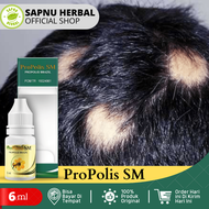 Obat Alopecia Areata Obat Pitak Obat Botak Koin Obat Penumbuh Rambut Botak Obat Rambut Pitak Obat Ti