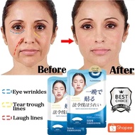 36pcs Japan Collagen Nasolabial Folds Patchs Smile Line Patch Anti Wrinkle