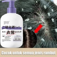 YanQi Psoriasis Shampoo Anti-Dandruff Shampoo Oil Control Shampoo Oil Control Itchy Scalp Treatment