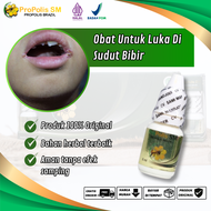 Obat Luka Di Sudut Bibir Angular Cheilitis Luka Ujung Bibir Sudut Bibir Putih / Hitam Bibir Luka Ber