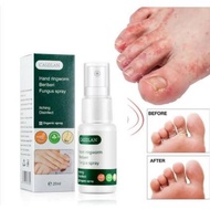 CAIZILAN Hand nail Ringworm beriberi fungus spray Terapi rawatan kuku anti kulat Semburan kulat kuli